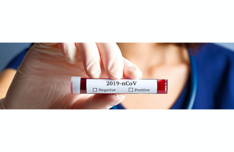 Mitos y verdades sobre el Covid–19