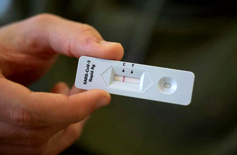 Casa Matriz refuerza medidas preventivas de contagio del personal con la entrega de Kit de Testeo de Antígeno COVID -19