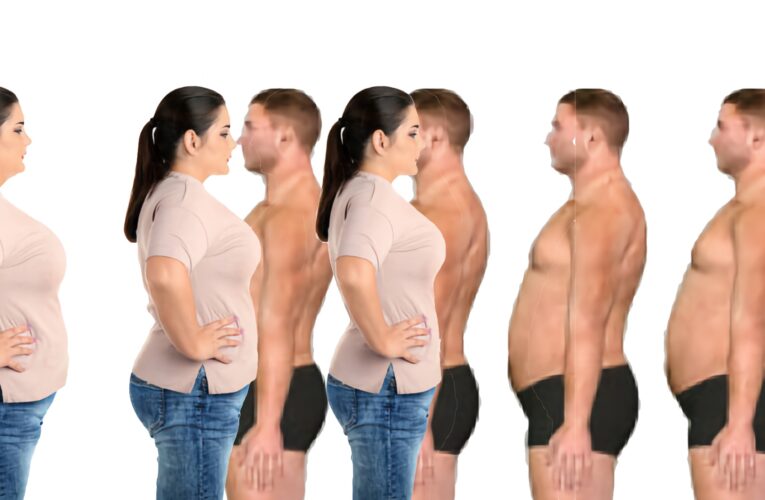 Científicos identifican cuatro tipos de obesidad según sus causas y características